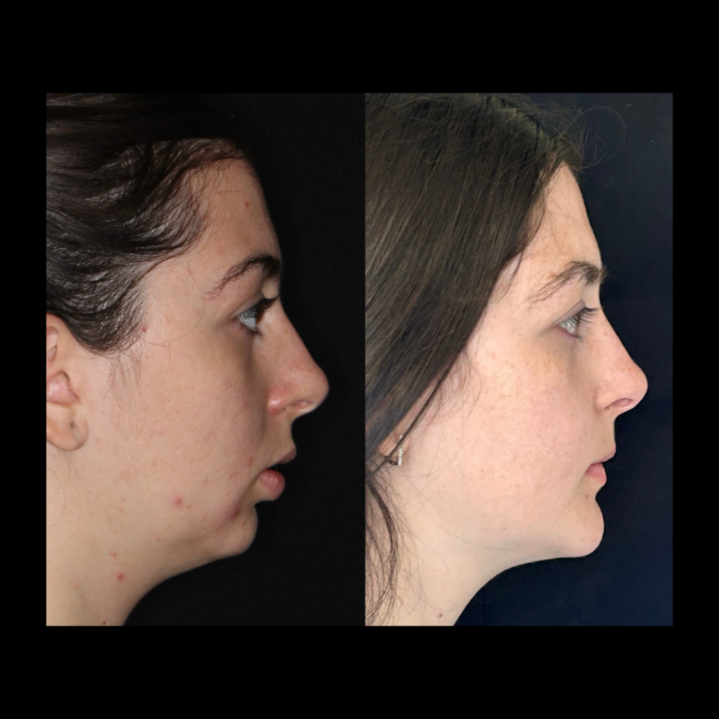 gabriel - A-D_10_web_Gorotti