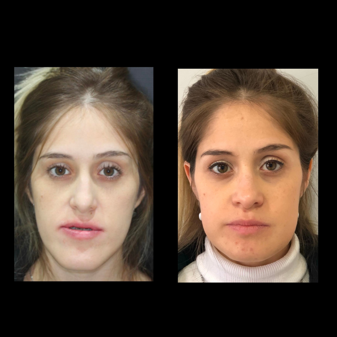 gabriel - A-D_11_web_Gorotti