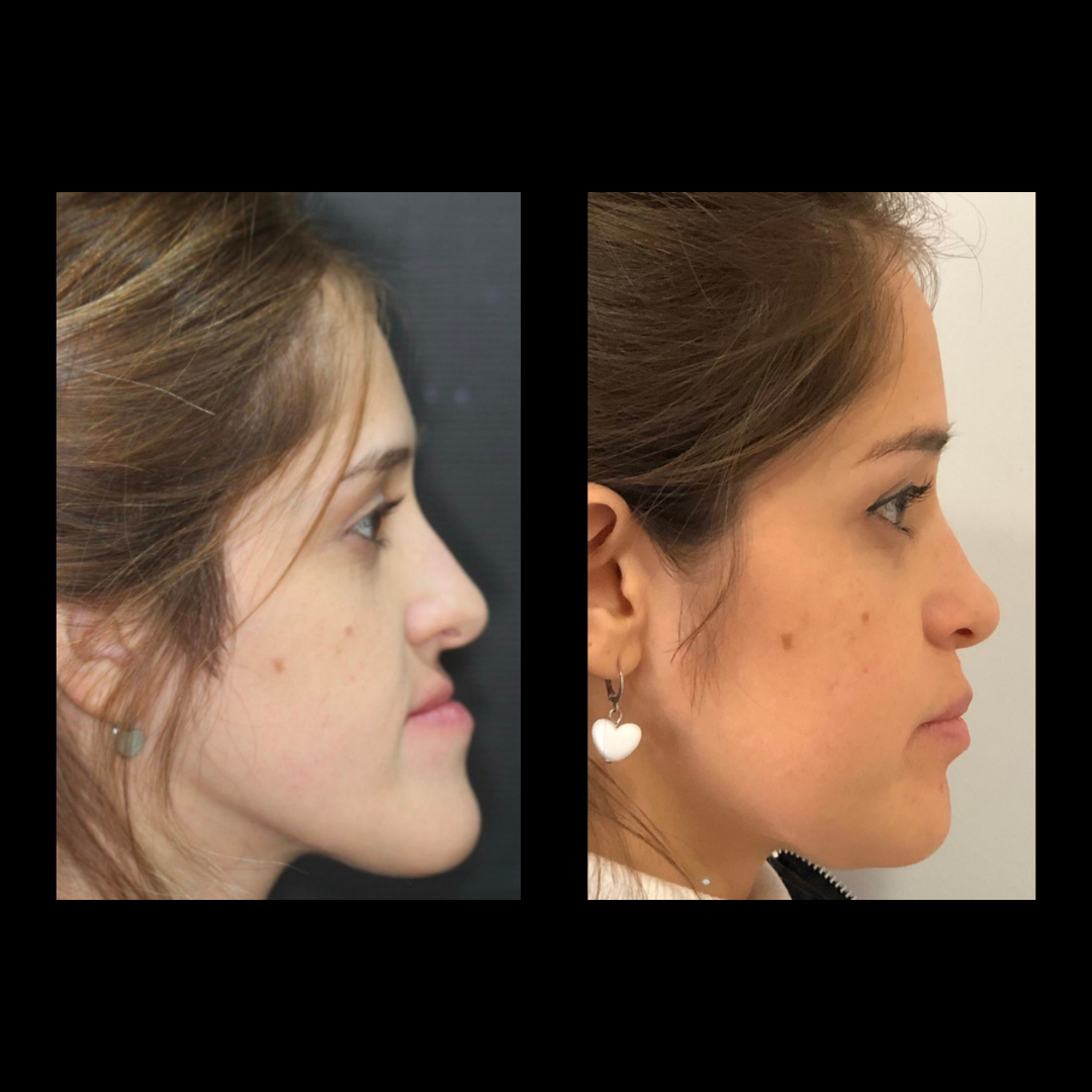 gabriel - A-D_12_web_Gorotti