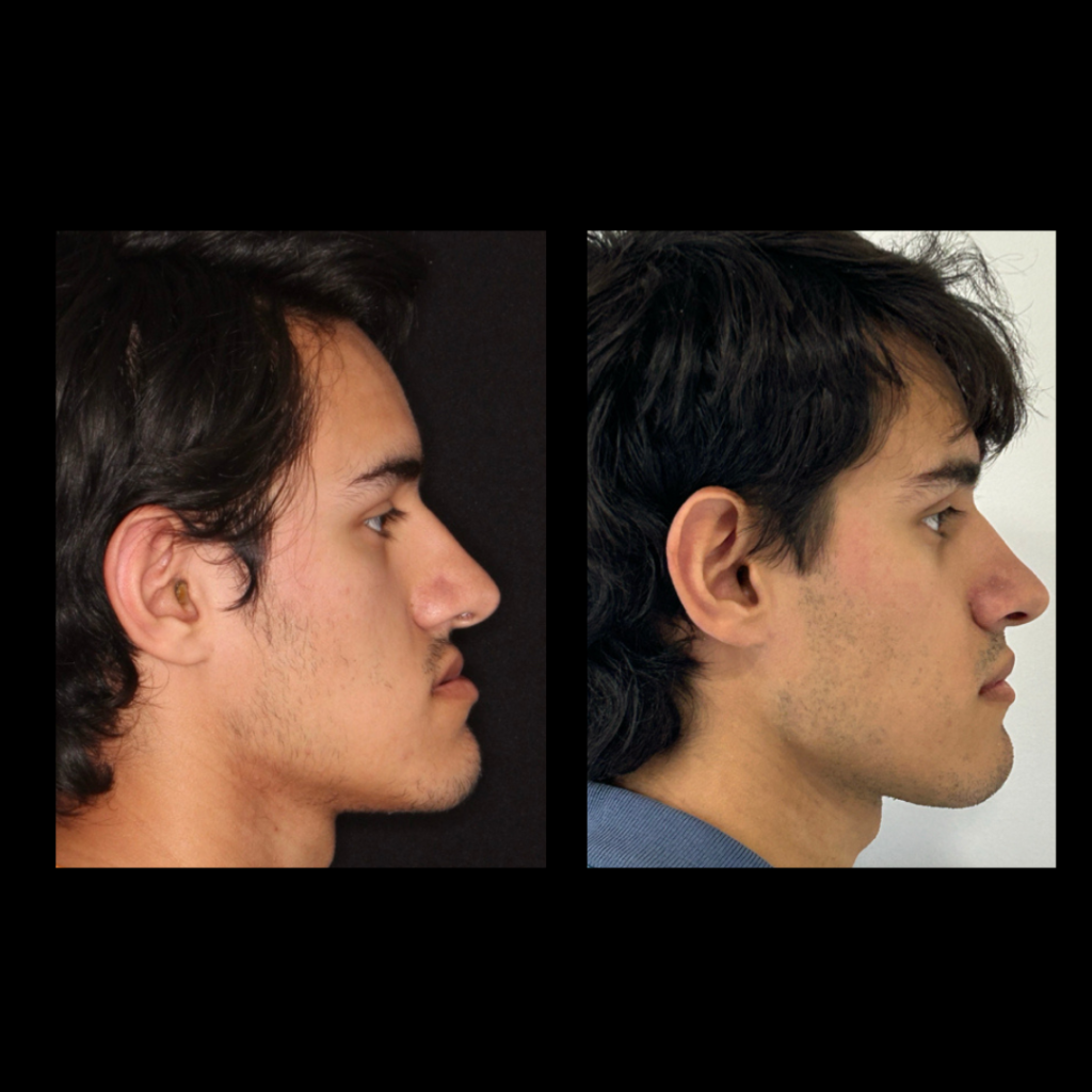 gabriel - A-D_13_web_Gorotti