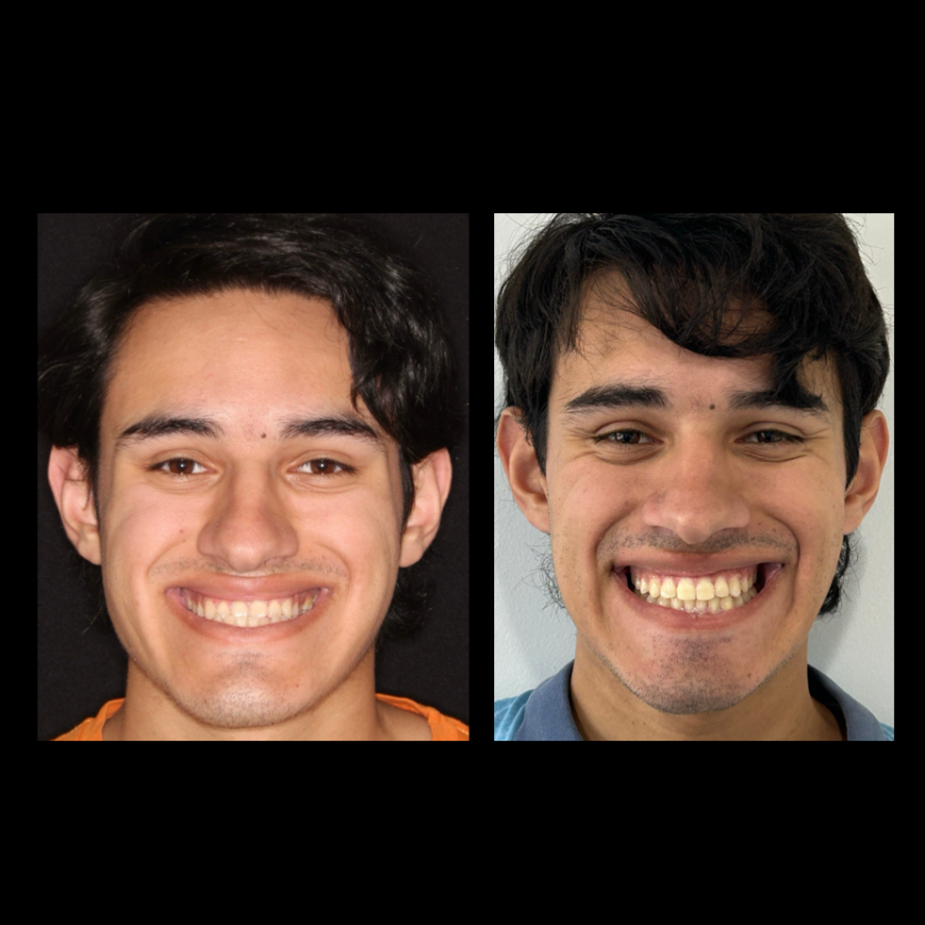 gabriel - A-D_14_web_Gorotti