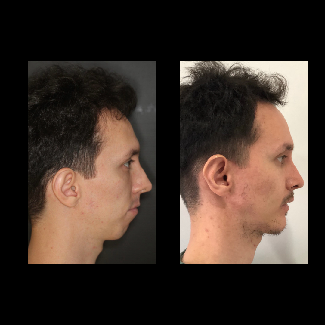 gabriel - A-D_15_web_Gorotti