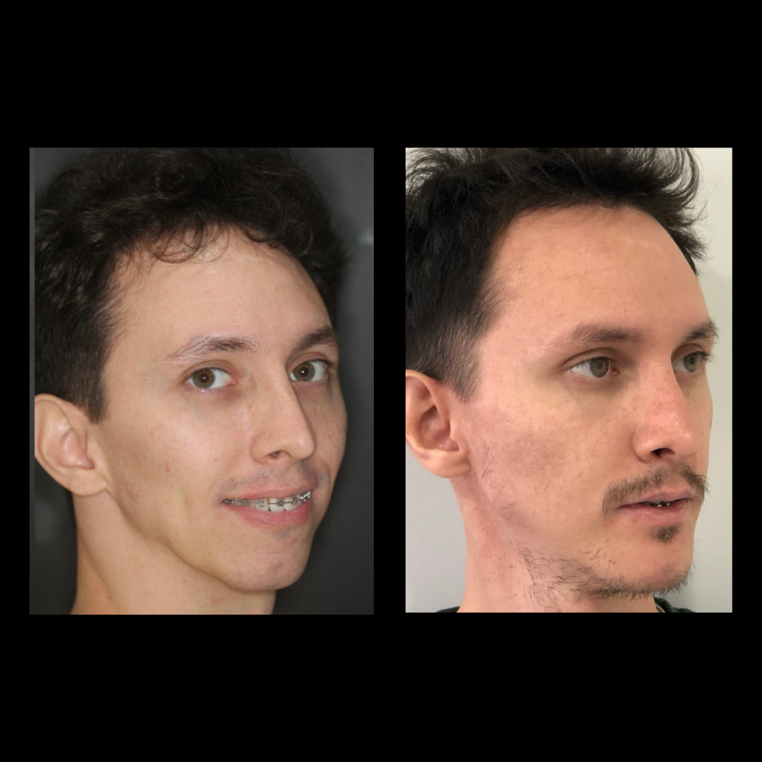 gabriel - A-D_16_web_Gorotti