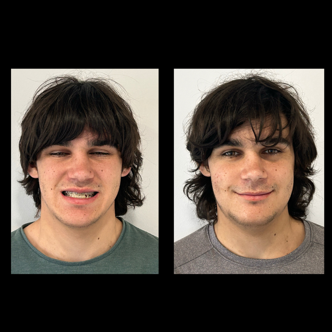 gabriel - A-D_18_web_Gorotti