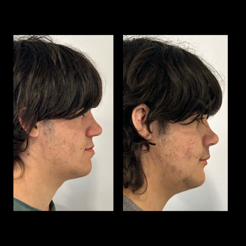 gabriel - A-D_19_web_Gorotti