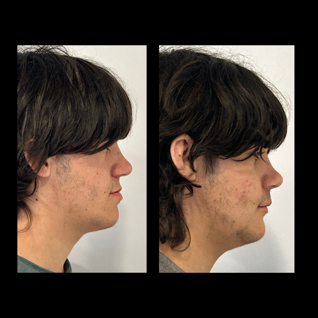 gabriel - A-D_19_web_Gorotti