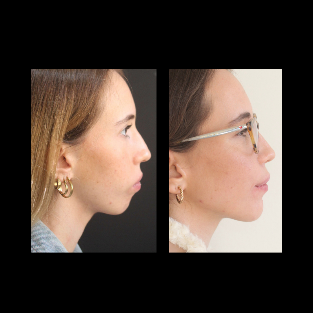 gabriel - A-D_20_web_Gorotti