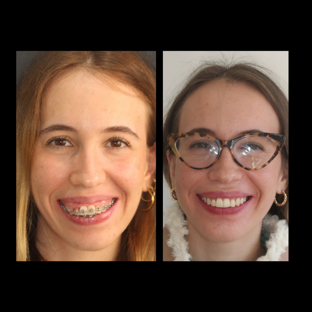 gabriel - A-D_22_web_Gorotti