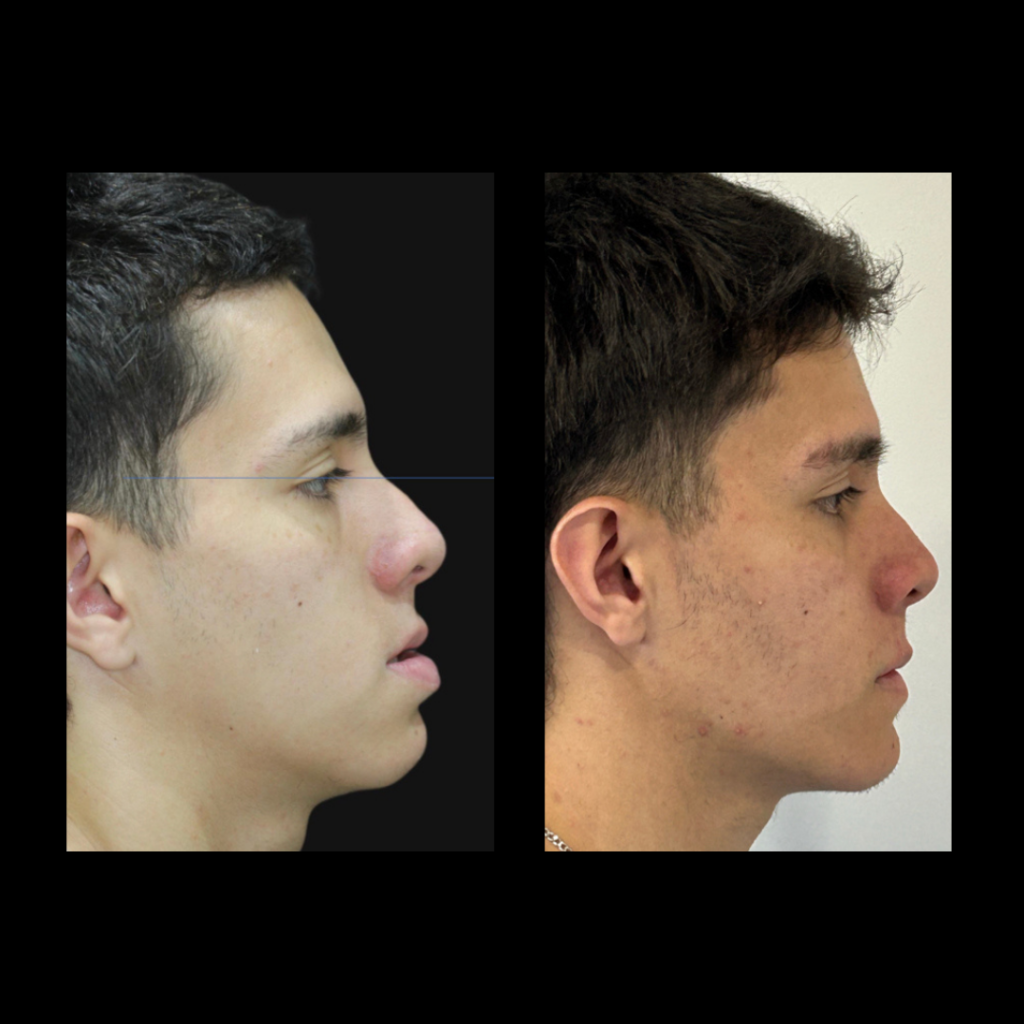 gabriel - A-D_23_web_Gorotti