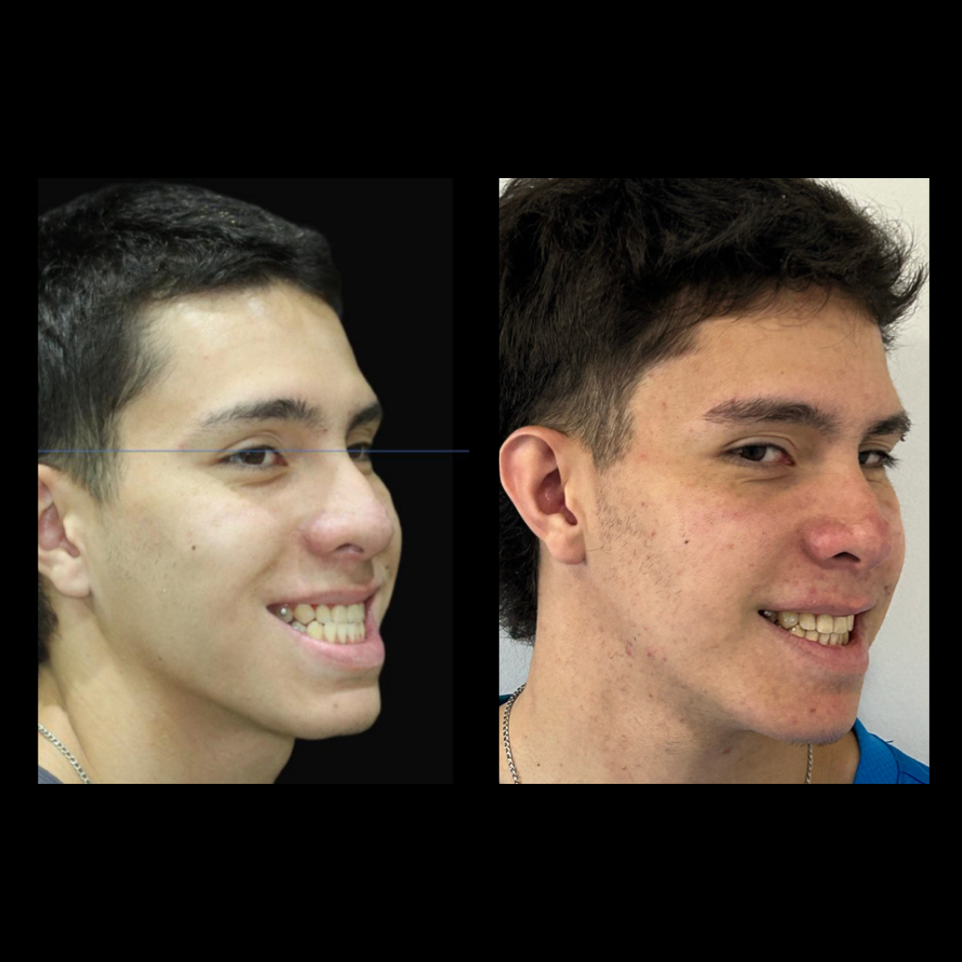 gabriel - A-D_24_web_Gorotti