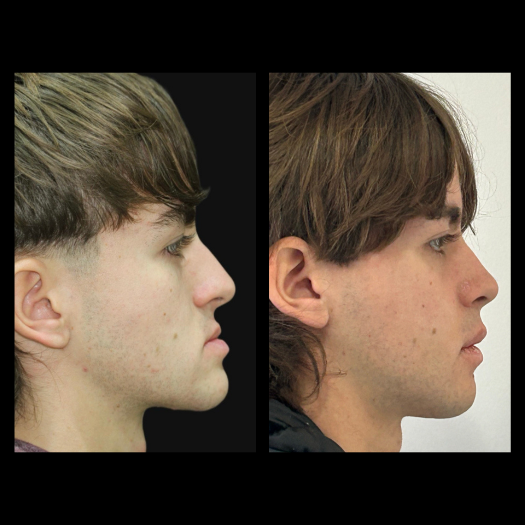 gabriel - A-D_2_web_Gorotti