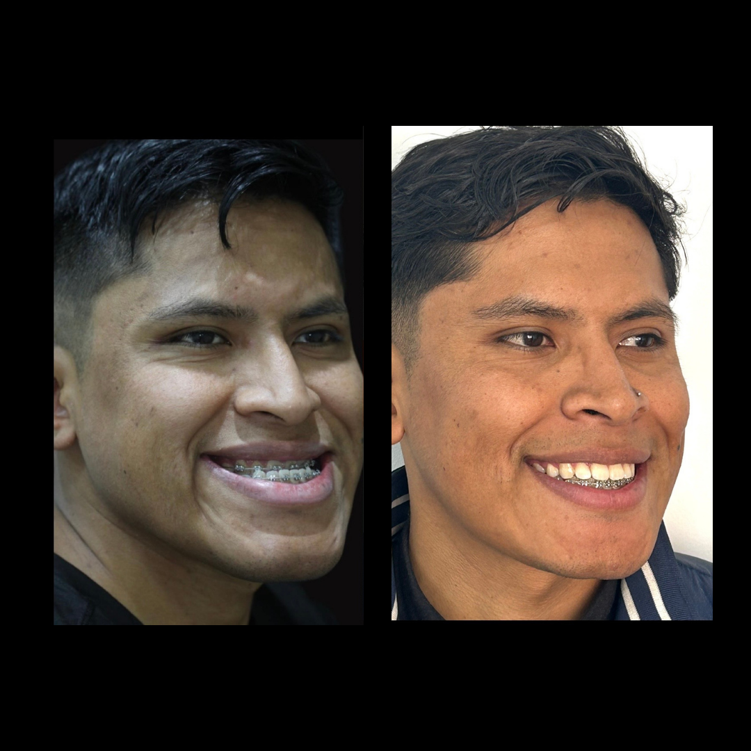 gabriel - A-D_3_web_Gorotti