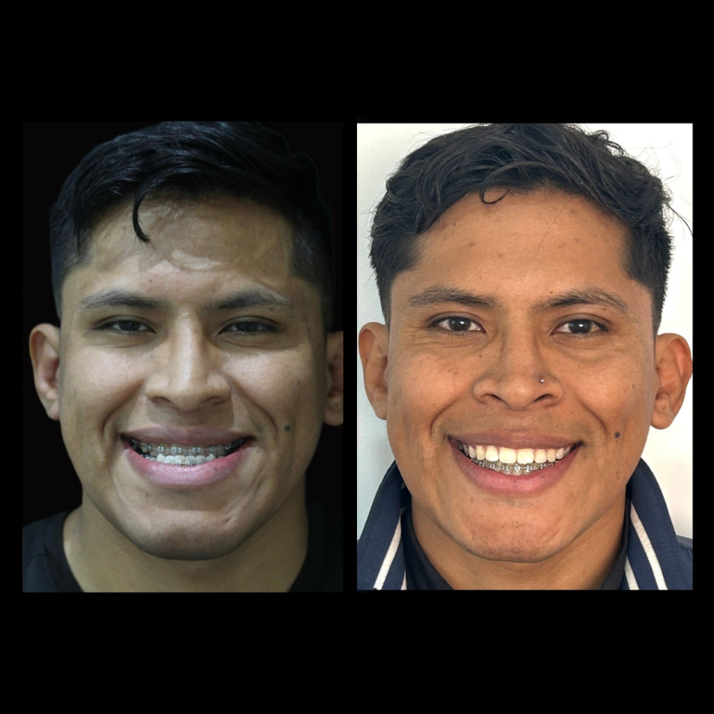 gabriel - A-D_4_web_Gorotti