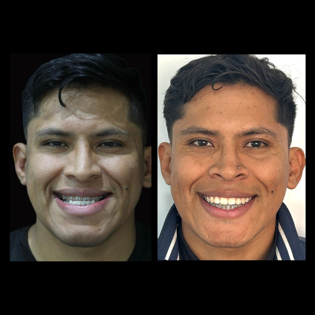 gabriel - A-D_4_web_Gorotti