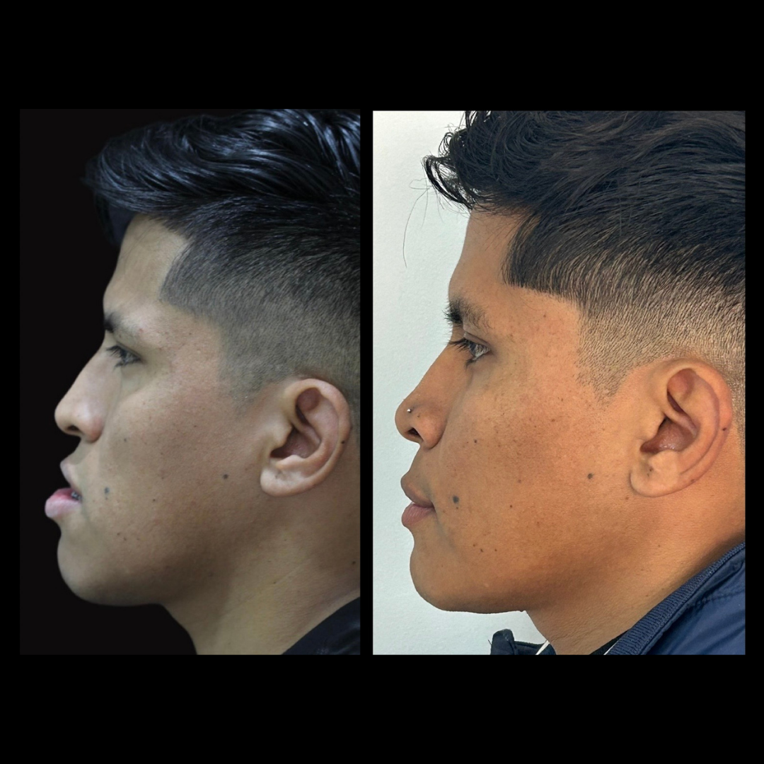 gabriel - A-D_5_web_Gorotti