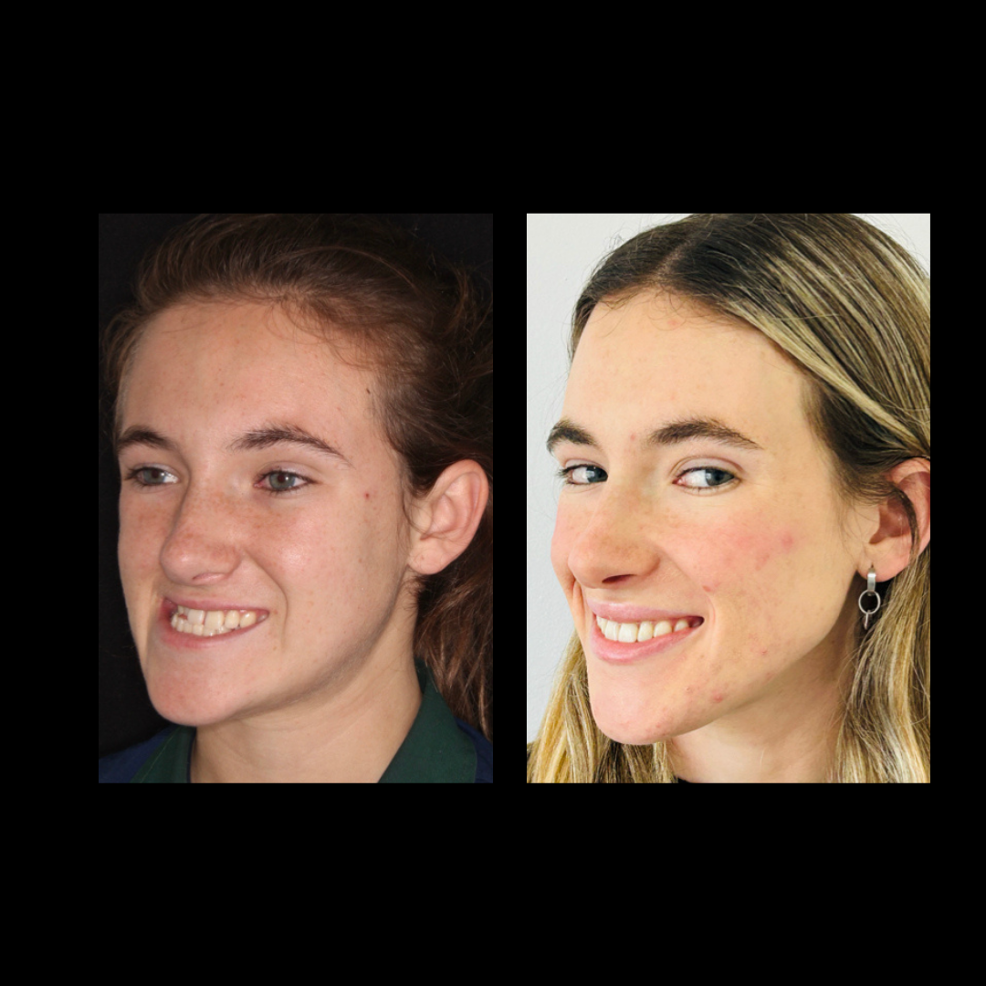 gabriel - A-D_6_web_Gorotti