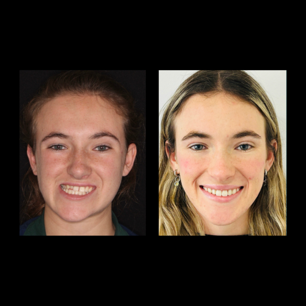 gabriel - A-D_7_web_Gorotti