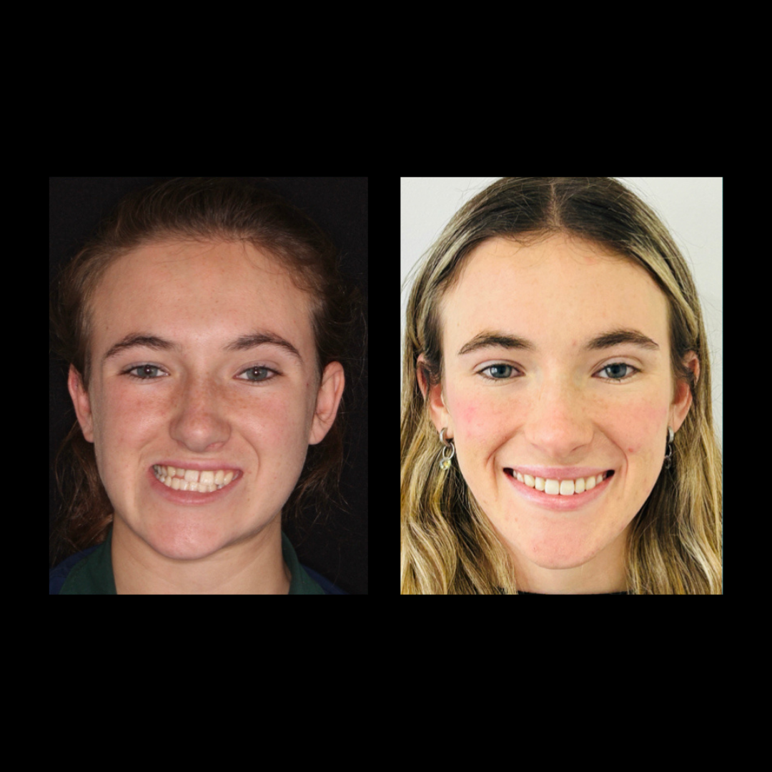 gabriel - A-D_7_web_Gorotti