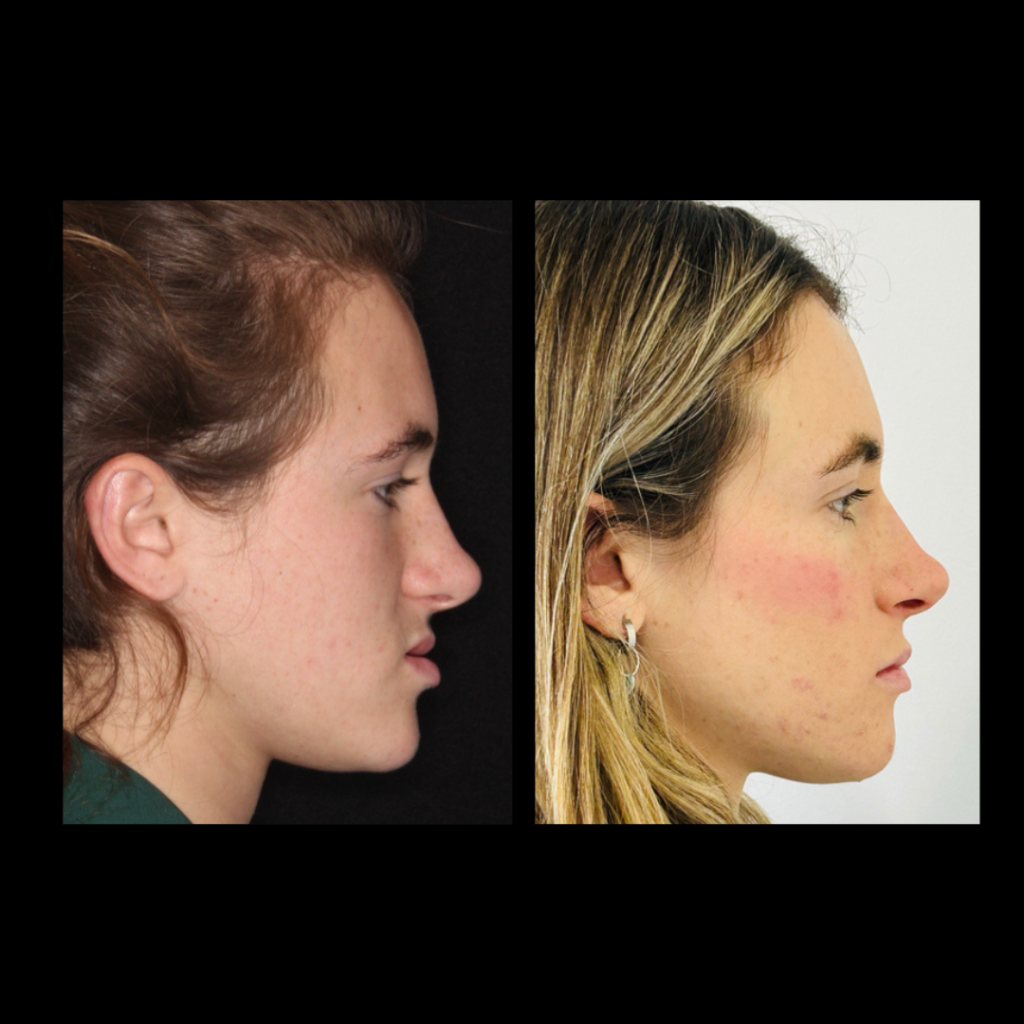 gabriel - A-D_8_web_Gorotti