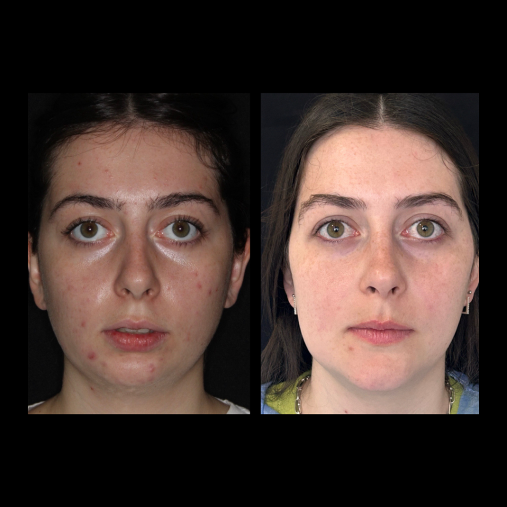 gabriel - A-D_9_web_Gorotti